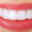 Good News About Porcelain Veneers