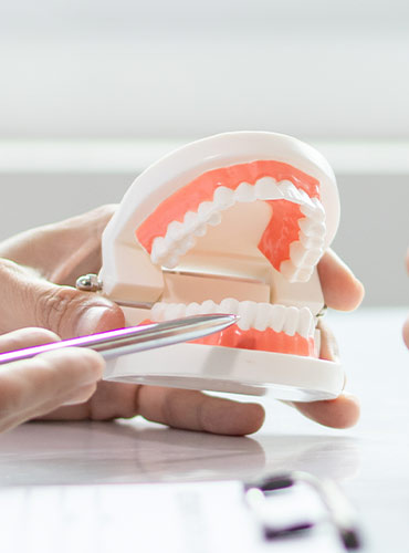 Minor Tooth Movement (MTM) - Care Advanced Dental