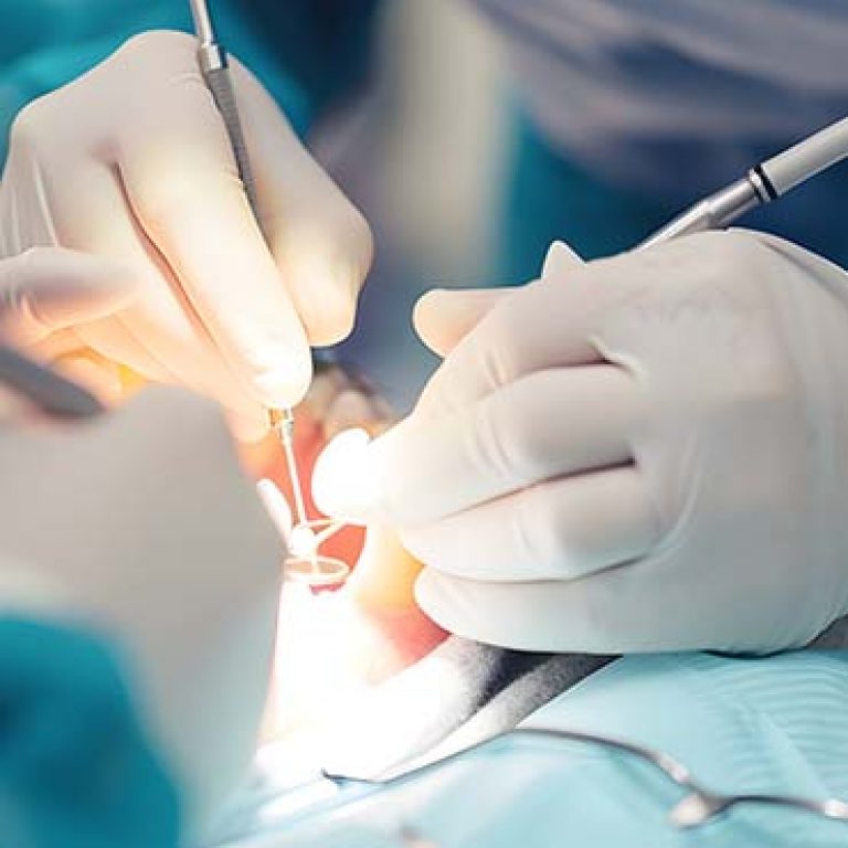 Dental surgeons conduct operation in patient oral cavity in clinic. Orthodontist with assistant provides stomatology treatment in hospital