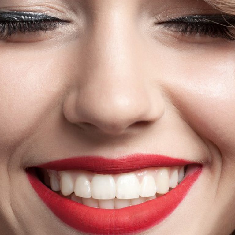 beautiful-straight-teeth-1-1000x520@2x