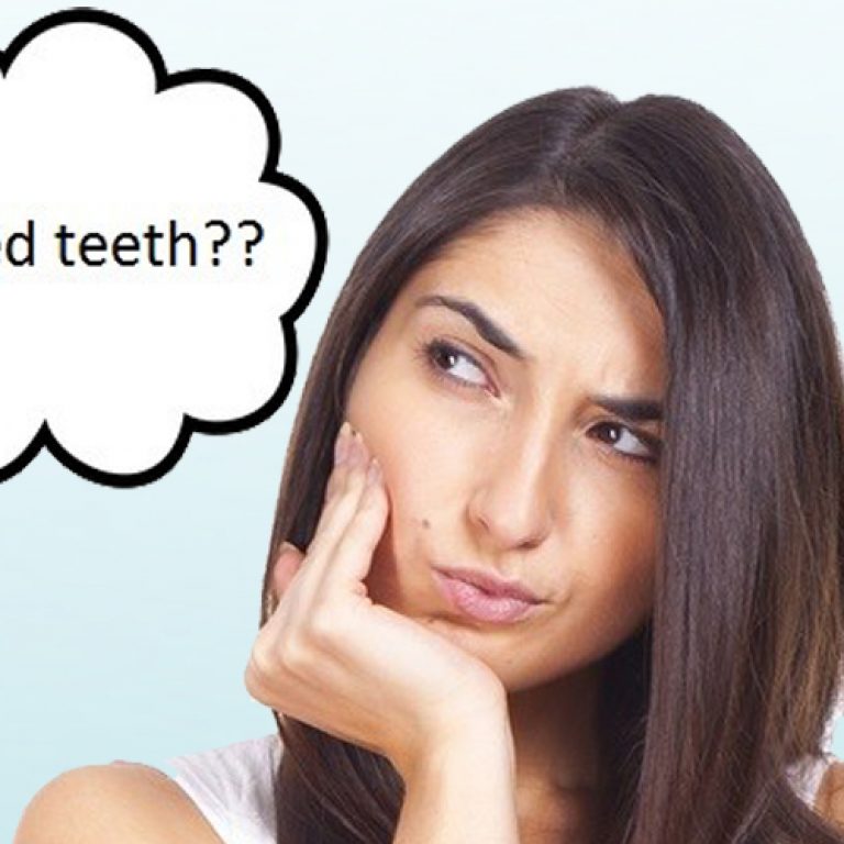 crooked-teeth-question-1-667x520@2x