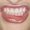 difficulties-of-teeth-grinding