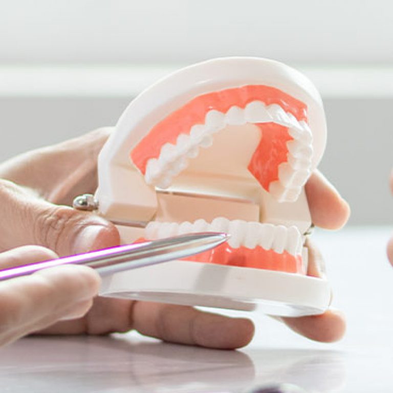 f-Minor-Tooth-Movement-01