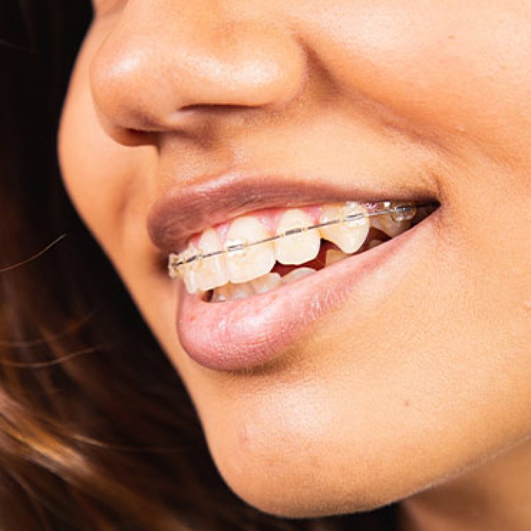 f-Six-Month-Smiles-01