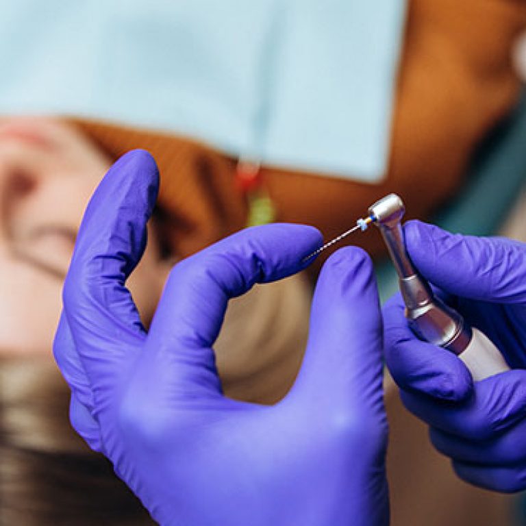 Closeup picture of dental instruments: drill and needle for root canal treatment and pulpitis in hand at the dentist