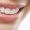 smilestraightwhite-1-1000x520@2x