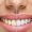 teeth_whitening