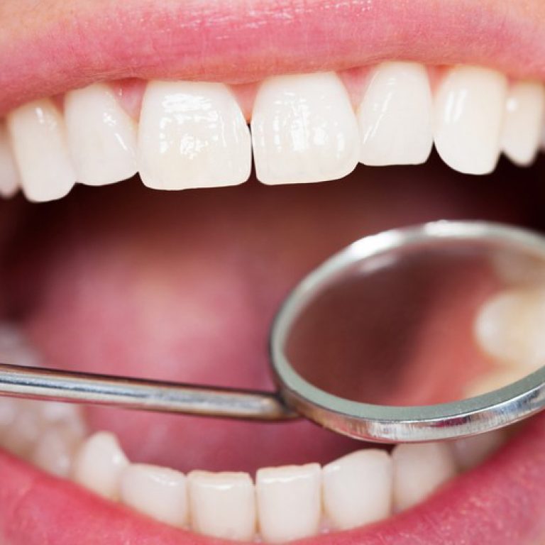 tooth-checkup-with-mirror-1-1000x520