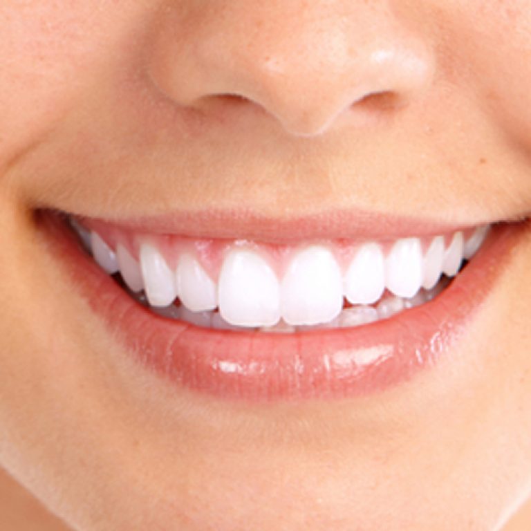 white-smile-close-up-1-1